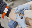 dialysis